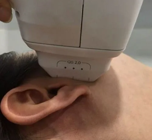 carmen sarmiento nature antiage ifu 1