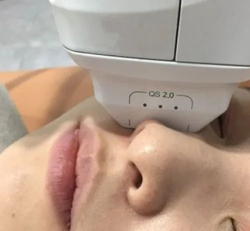 carmen sarmiento nature antiage ifu 2