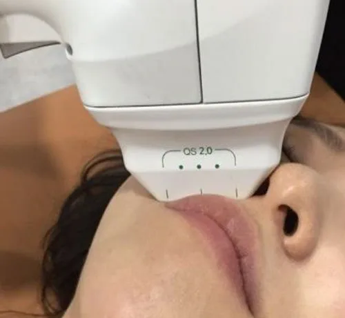 carmen sarmiento nature antiage ifu 3