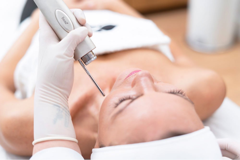 Promociones-centros-carmen-sarmiento-lifting-facial-skinlifting4d-junio.jpg Lifting facial no quirúrgico con Skin LIfting 4D en Carmen Sarmiento.