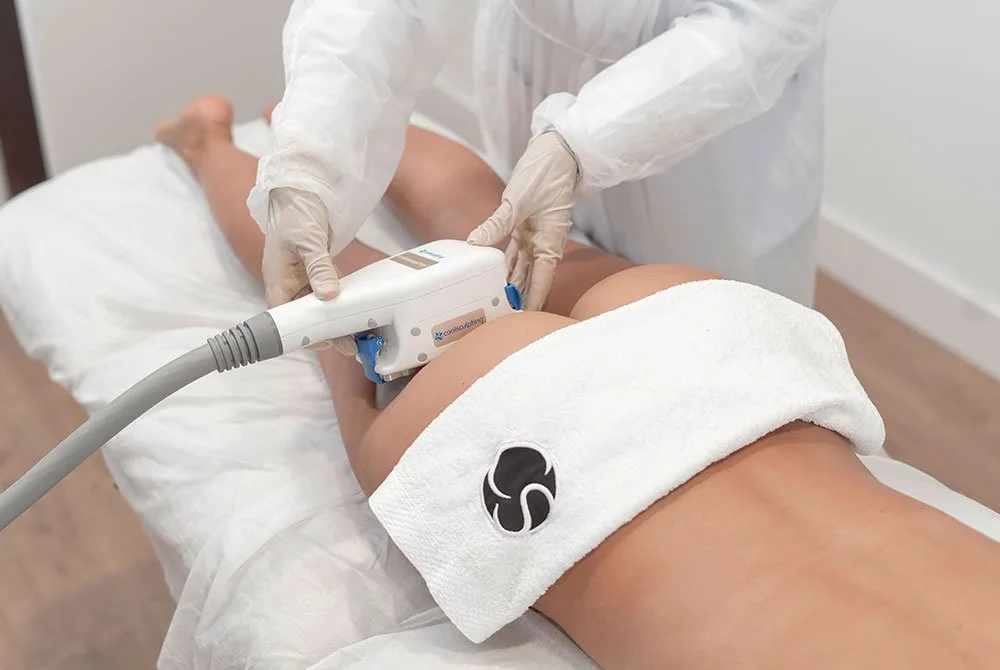 Adiós a los "banana rolls" con el nº1 Coolsculpting en Carmen Sarmiento, en su centro de Medicina Estética de Marqués de Paradas, en Sevilla.