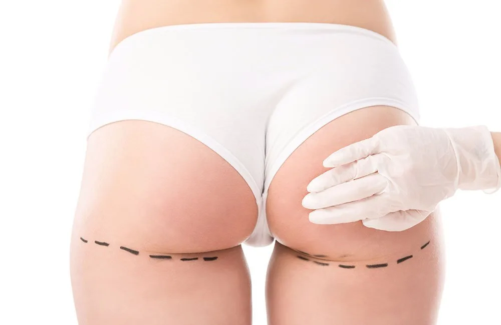 Adiós a los "banana rolls" con el nº1 Coolsculpting en Carmen Sarmiento, en su centro de Medicina Estética de Marqués de Paradas, en Sevilla.