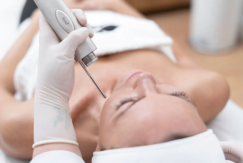 Skin Lifting 4D para tratar el envejecimiento prematuro de la piel en Carmen Sarmiento