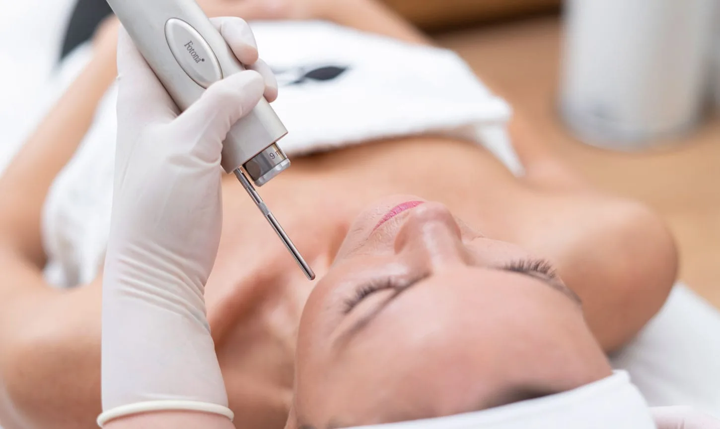 Skin Lifting Láser 4D Skin Lifting Láser 4D