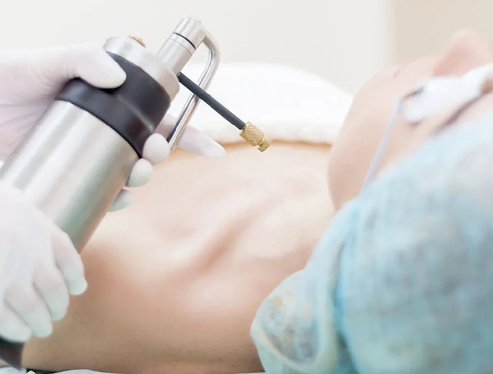 Eliminar los puntos de rubi Eliminar los puntos de rubi