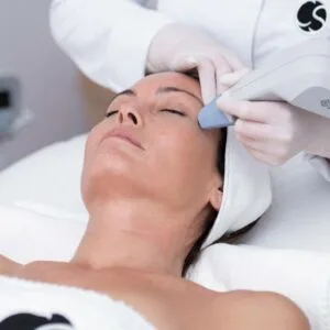Carmen Sarmiento - Exilis Elite Facial