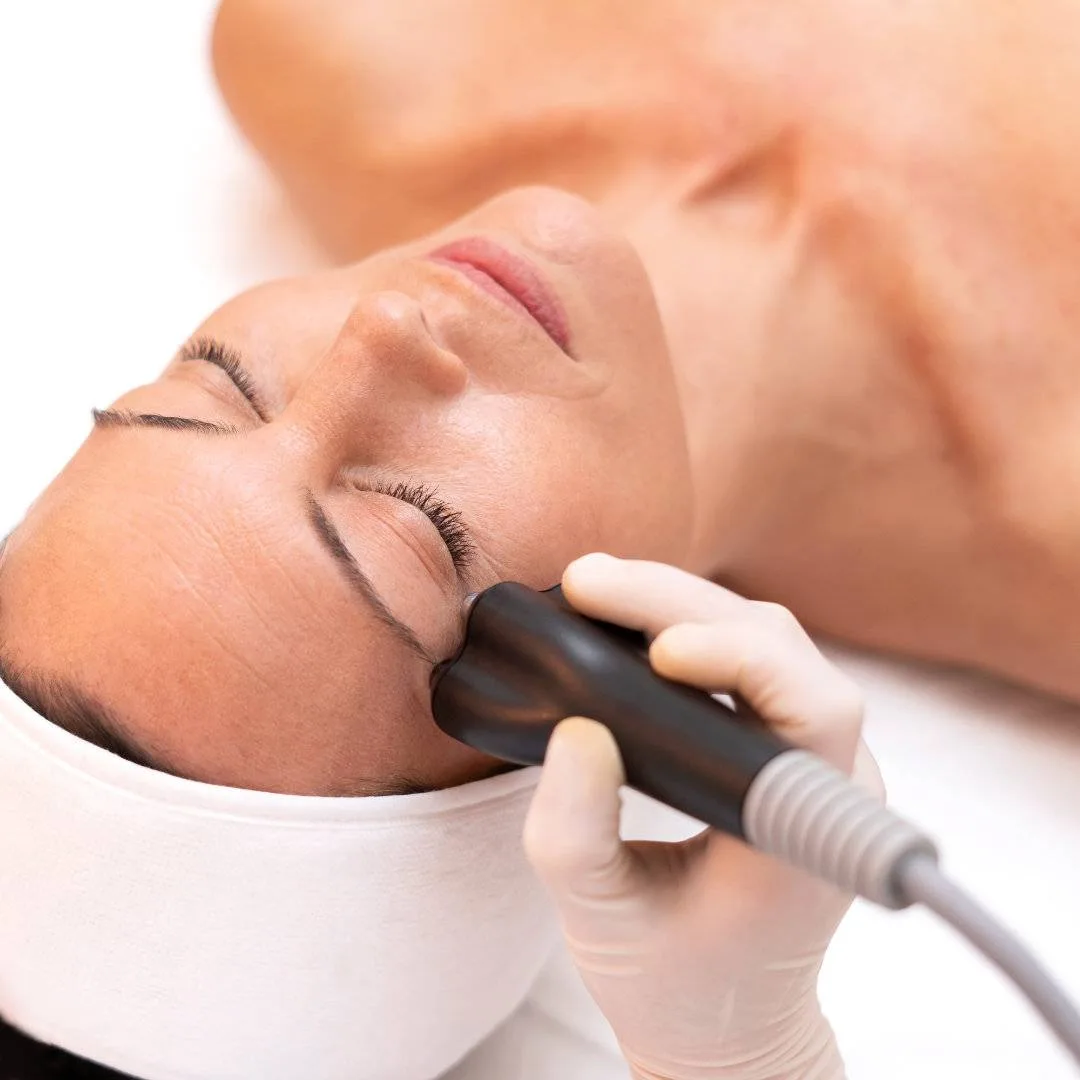 Carmen Sarmiento - Radio Frecuencia Facial - Venus Freeze