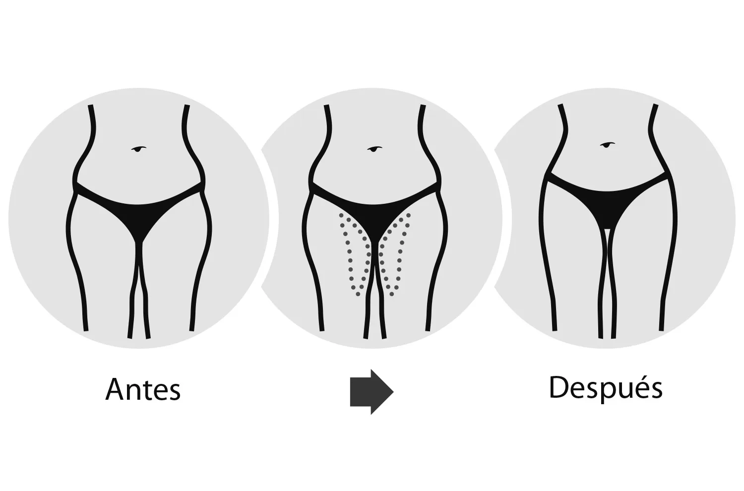 Retensa y reafirma la parte interna del muslo