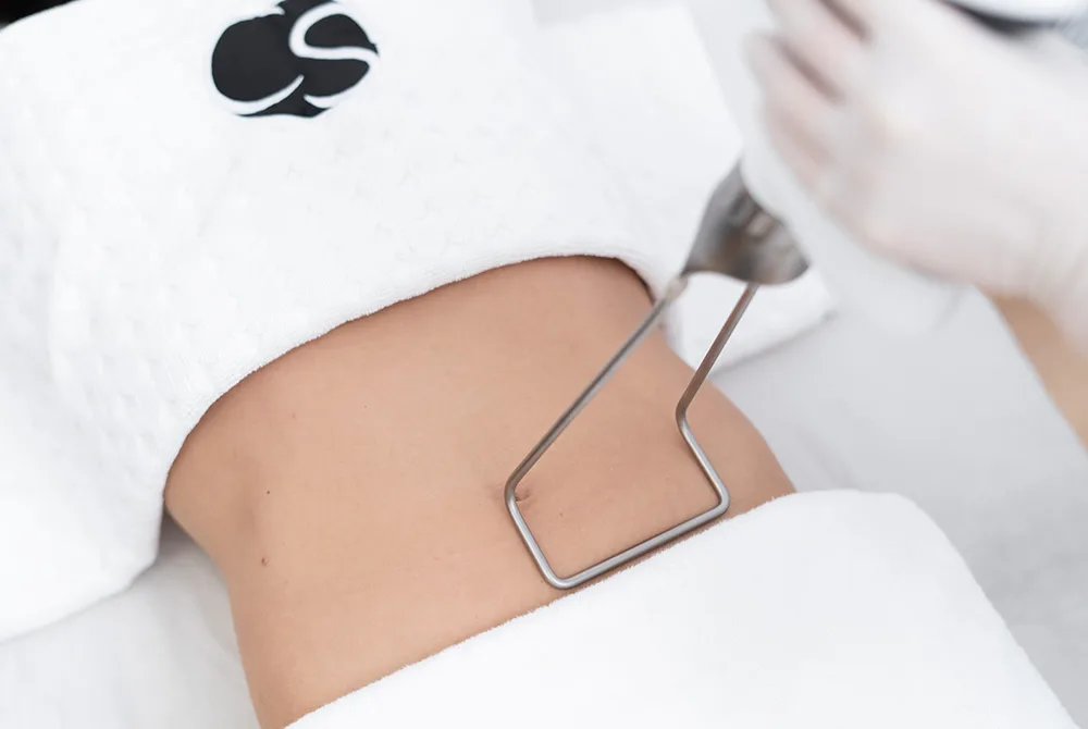 Elimina la Vientre flácido y laxitud abdominal en Carmen Sarmiento