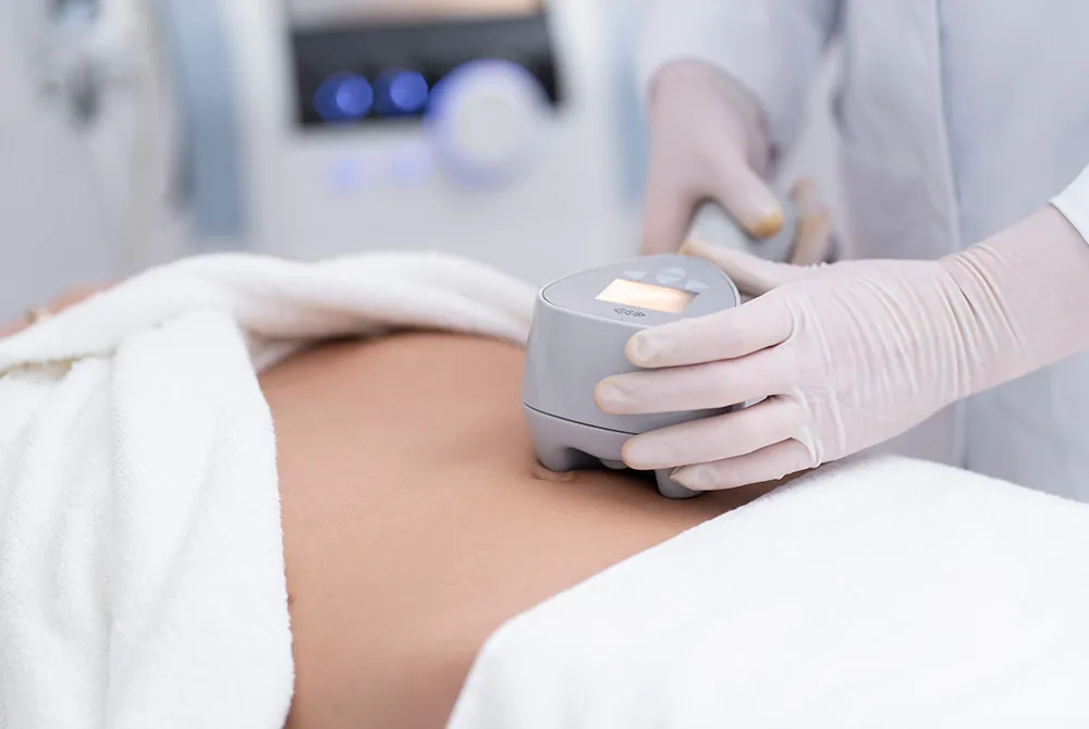 Elimina la Vientre flácido y laxitud abdominal en Carmen Sarmiento