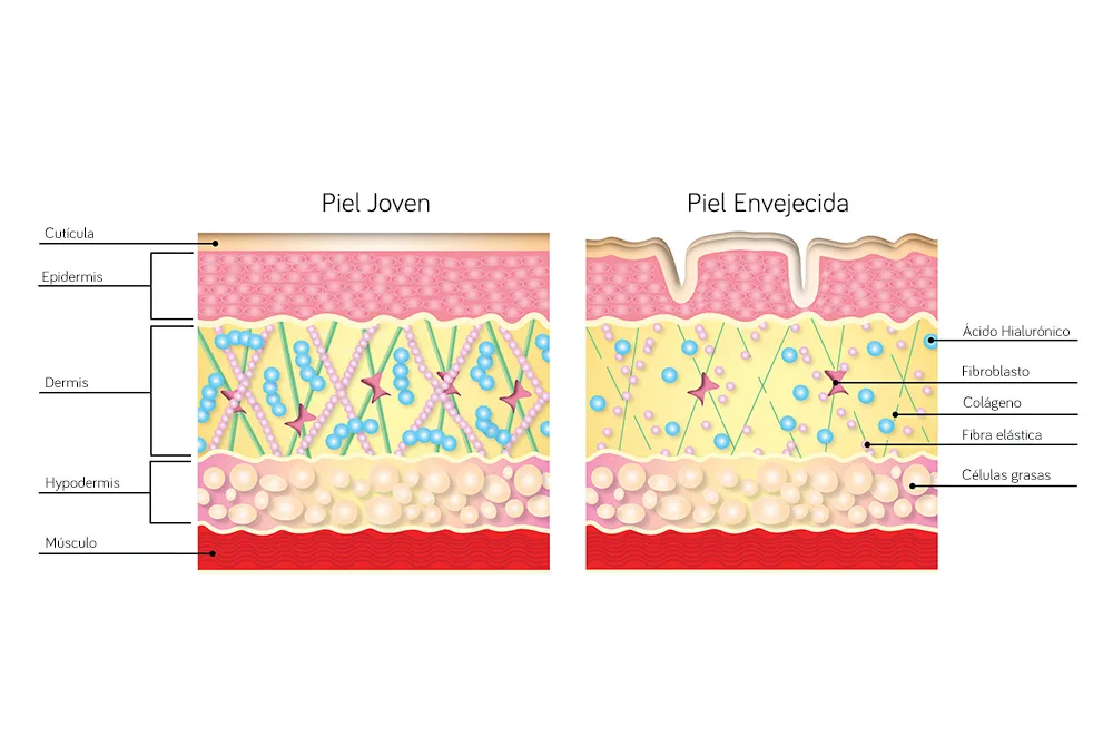 Elimina la Vientre flácido y laxitud abdominal en Carmen Sarmiento