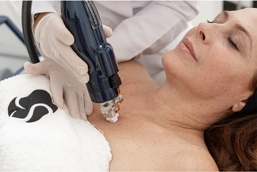 Elimina las manchas del escote tras el verano en Carmen Sarmiento