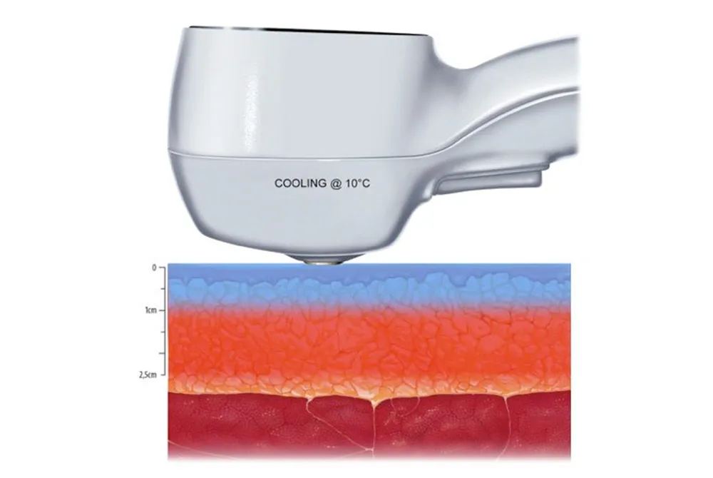 Elimina las manchas del escote tras el verano en Carmen Sarmiento