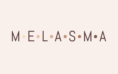 Tratamiento del Melasma: qué es, causas y tratamiento en Carmen Sarmiento