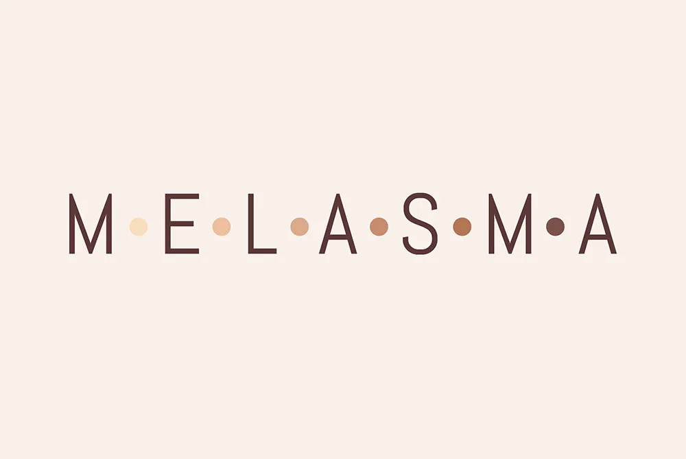 Tratamiento del Melasma: qué es, causas y tratamiento Tratamiento del Melasma: qué es, causas y tratamiento
