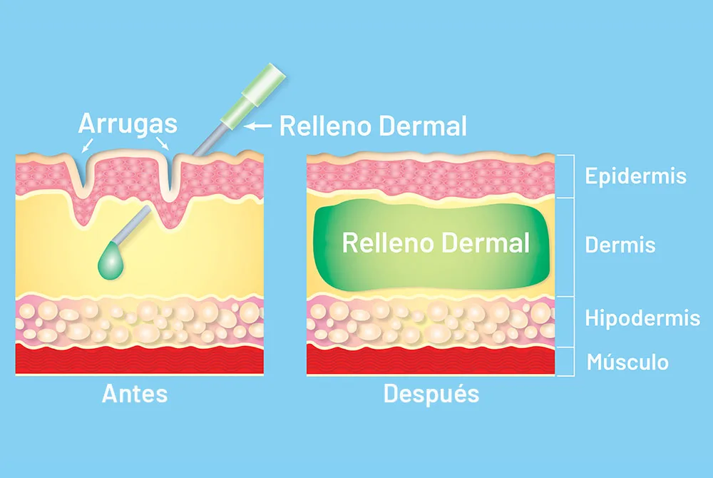 Cómo marcar la mandíbula, consíguelo en CS