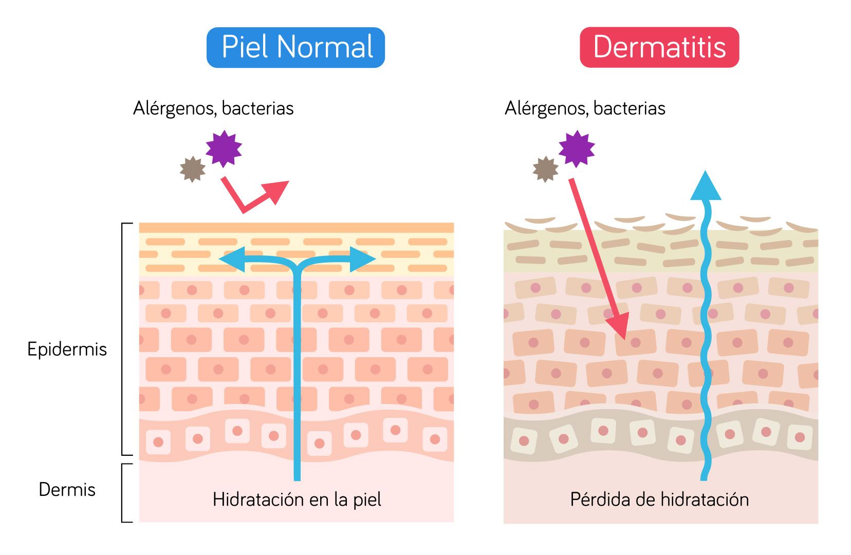 Diferencias entre la piel normal y la piel sensible, pérdida de hidratación, trátala en CS