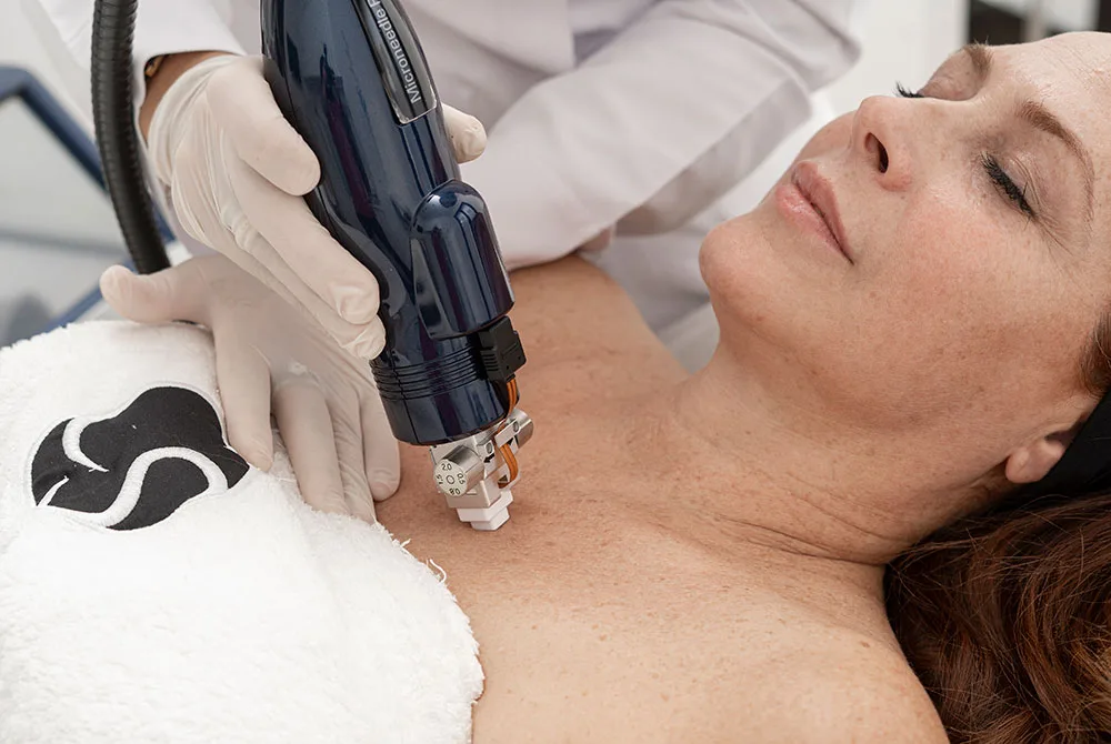 Tratamientos para rejuvenecer cuello y escote no quirúrgicos Tratamientos para rejuvenecer cuello y escote no quirúrgicos