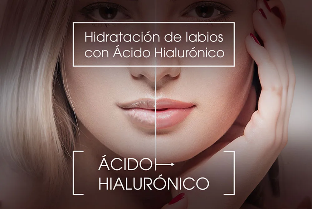 Hidratación de labios los mejores tratamientos Hidratación de labios los mejores tratamientos