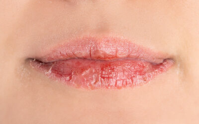 Hidratación de labios los mejores tratamientos