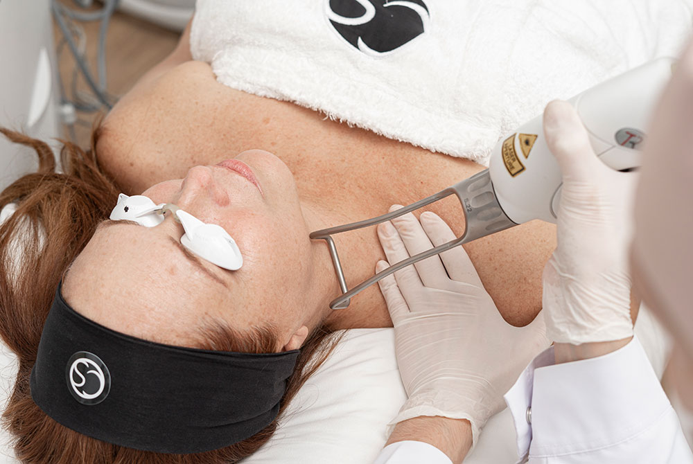 Lifting facial sin cirugía