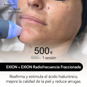 EXION + EXION Radiofrecuencia Fraccionada