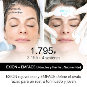 EXION + EMFACE (Pómulos y Frente o Submentón)