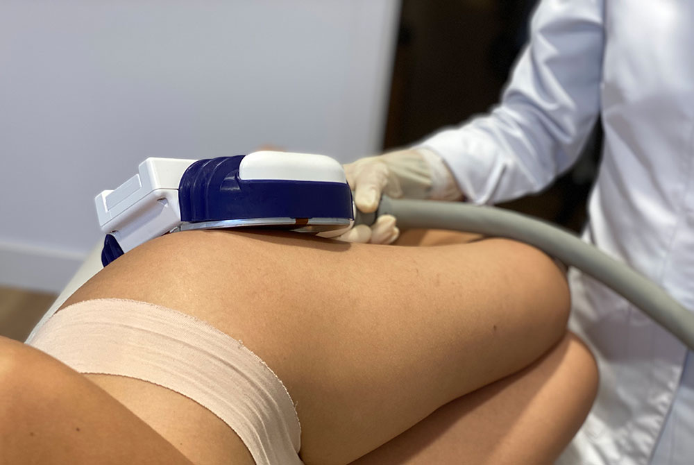 El secreto para eliminar las cartucheras en la mujer El secreto para eliminar las cartucheras en la mujer