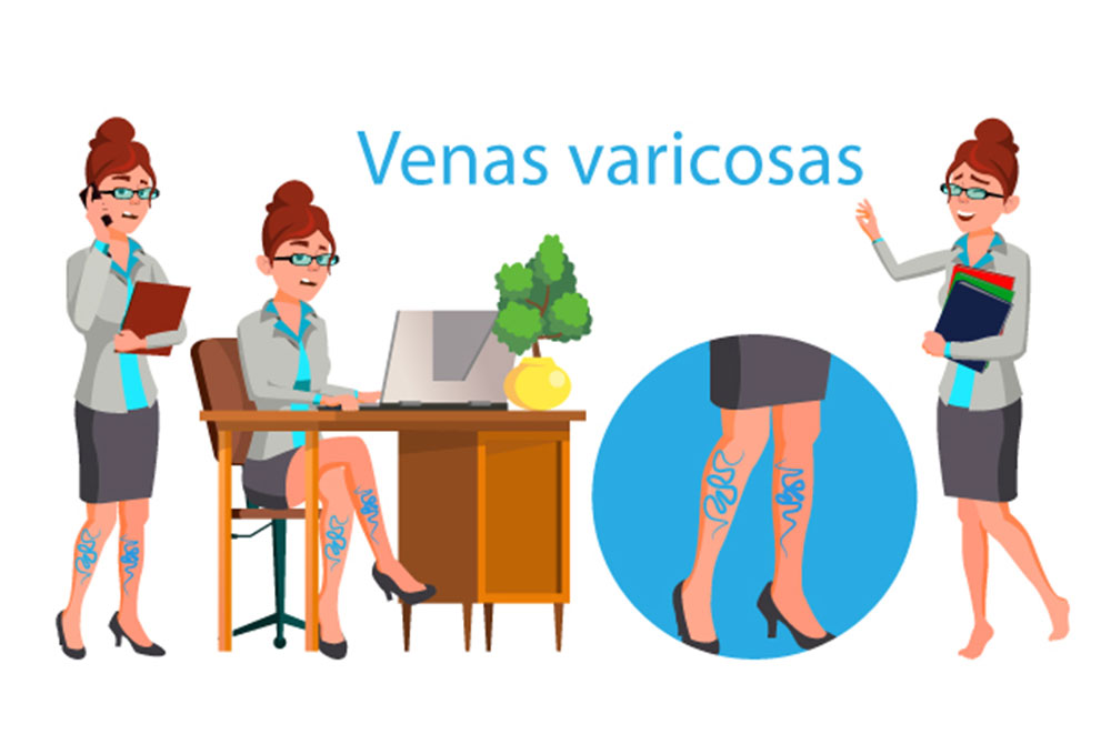 blog-carmen-sarmiento-tipos-varices-07 Tipos de varices cómo tratarlas de forma eficaz