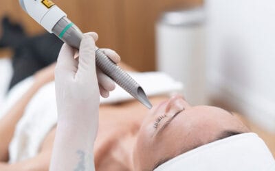 Láser facial rejuvenece tu piel sin cirugía