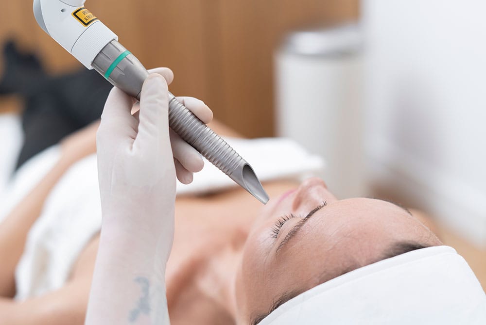 Laser facial, descubre nuestros tratamientos láser en Carmen Sarmiento Laser facial, descubre nuestros tratamientos láser en Carmen Sarmiento