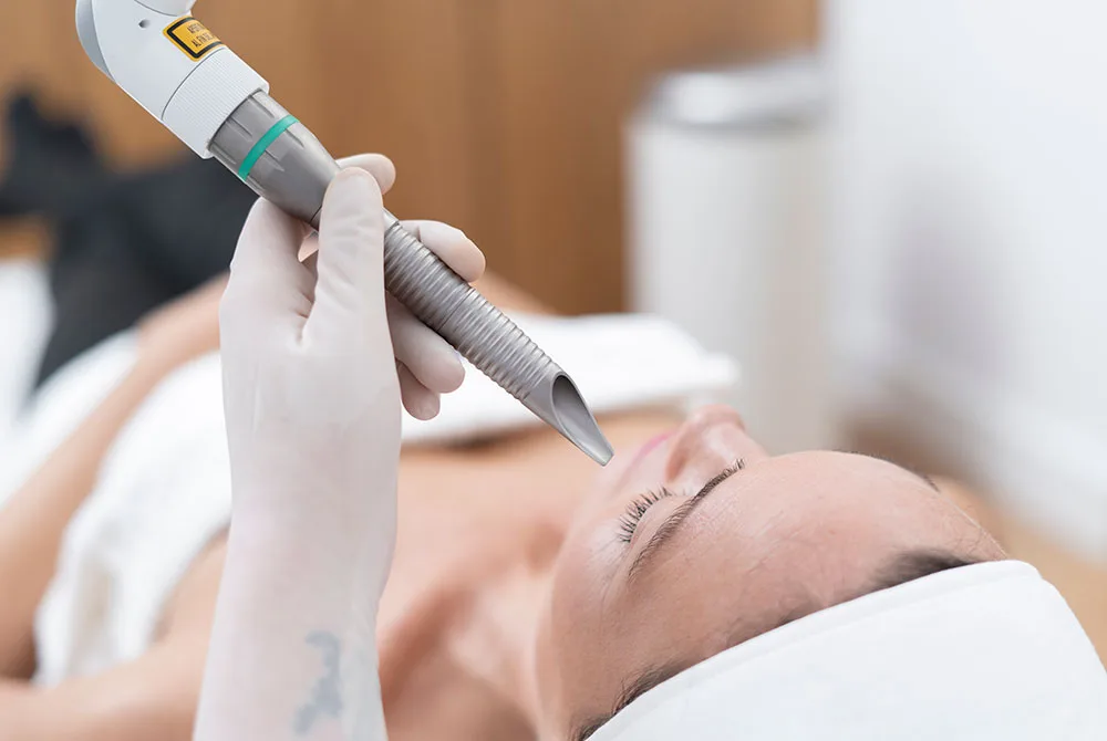 Láser facial rejuvenece tu piel sin cirugía