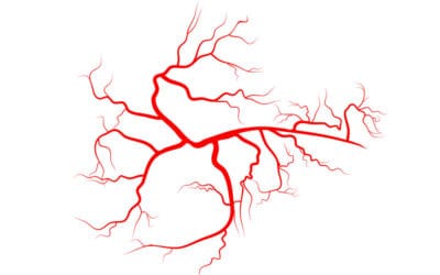 Club CS - Programa de Puntos 1 Elimina las arañas vasculares de forma eficaz y rápida