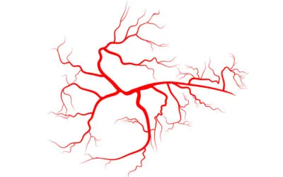Carmen Sarmiento. Centro de Medicina Estética 9 Elimina las arañas vasculares de forma eficaz y rápida