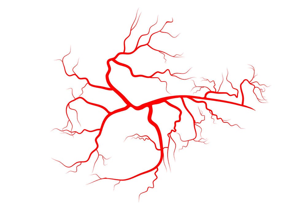 Elimina las arañas vasculares de forma eficaz y rápida