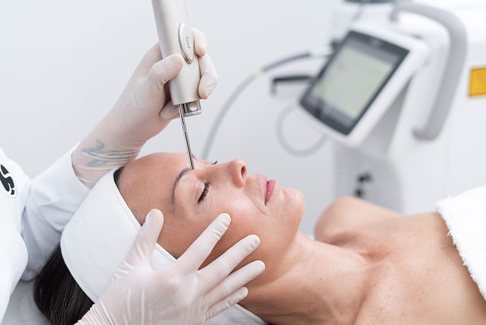 Laser facial, descubre nuestros tratamientos láser en Carmen Sarmiento Laser facial, descubre nuestros tratamientos láser en Carmen Sarmiento