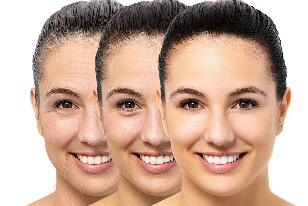 Medicina estética preventiva - Proceso de envejecimiento Medicina estética preventiva en Carmen Sarmiento