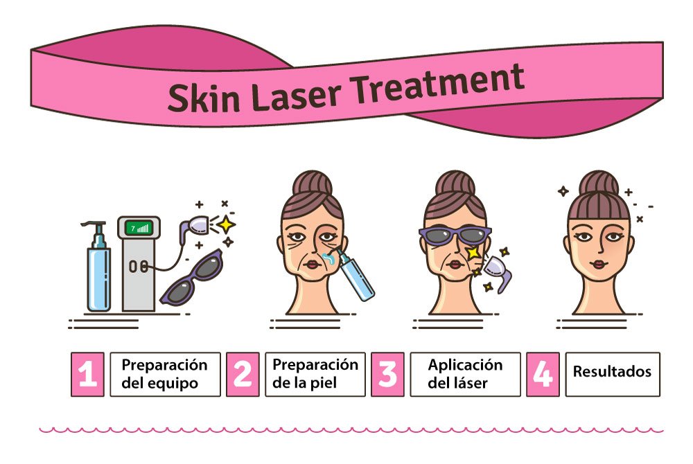 Medicina estética preventiva - Tratamiento láser infografía Medicina estética preventiva en Carmen Sarmiento