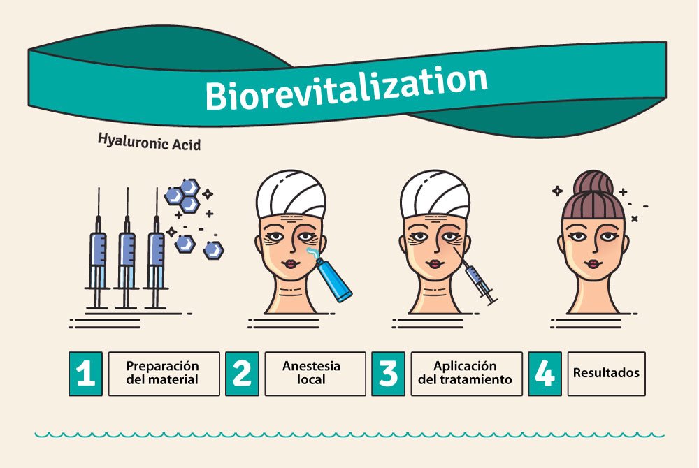 Infografia sobre los pasos de un tratamiento de revistalización para la piel Medicina estética preventiva en Carmen Sarmiento