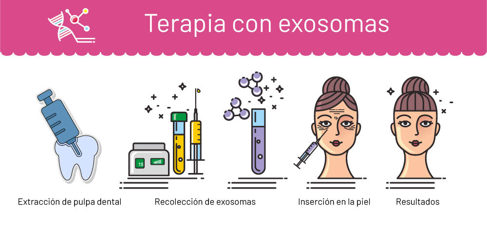 Terapia con exosomas, en Carmen Sarmiento