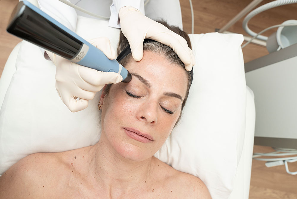 Imagen de tratamiento de radiofrencuencia facial en Carmen Sarmiento Tratamientos con radiofrecuencia para medicina estética