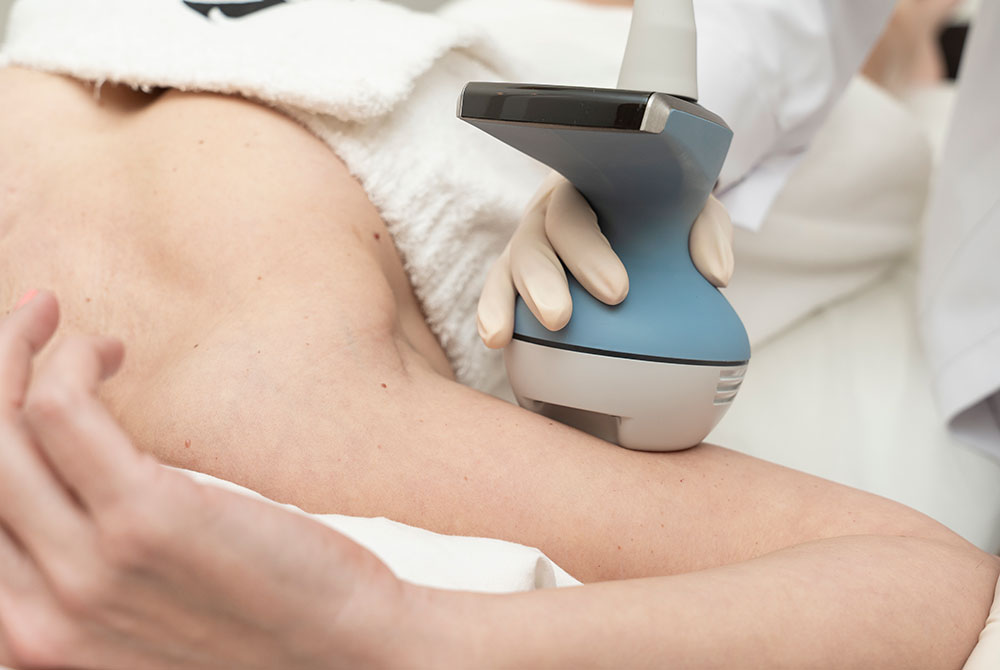 Imagen de tratamiento de radiofrecuencia corporal en brazos en Carmen Sarmiento Tratamientos con radiofrecuencia para medicina estética