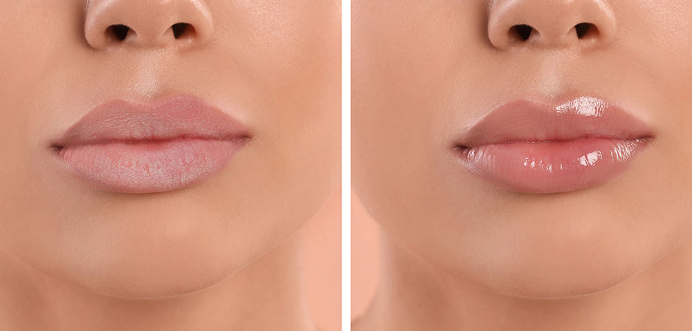 Hidratación de labios Hidratación de labios